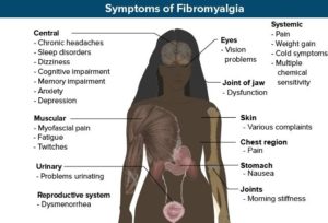 Fibromyalgia Symptoms, Clarion PA